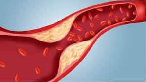 Việt Nam: Phát hiện cây thuốc quý mọc khắp nơi trị rối loạn lipid máu